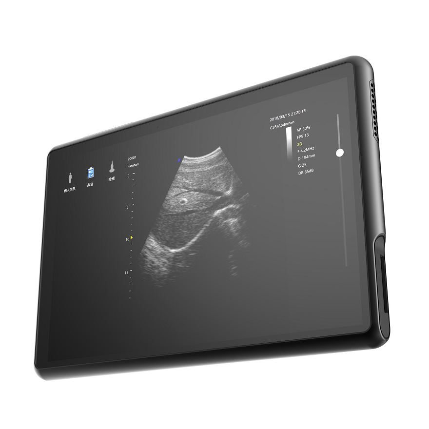 Portable tablet color ultrasound